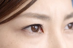 目