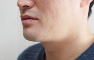 首のシワがある男性